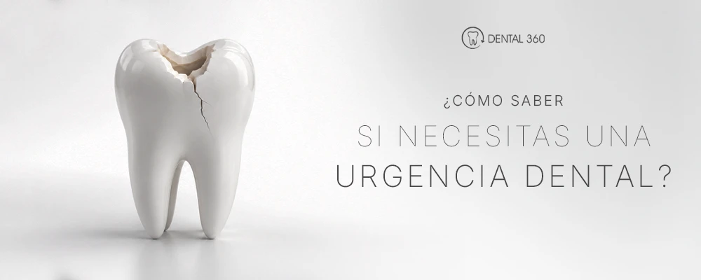 Diente fracturado junto al texto cómo saber si necesitas una urgencia dental