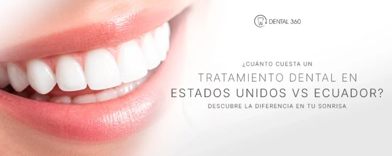 Sonrisa blanca junto al texto sobre cuánto cuesta un tratamiento dental en Estados Unidos versus Ecuador