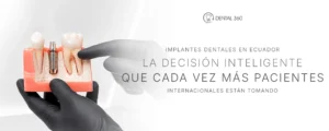 Modelo de implante dental junto al texto implantes dentales en Ecuador para pacientes internacionales