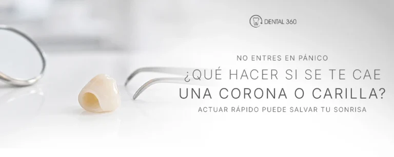Corona dental caída junto a instrumentos odontológicos y texto sobre qué hacer si se cae una corona o carilla