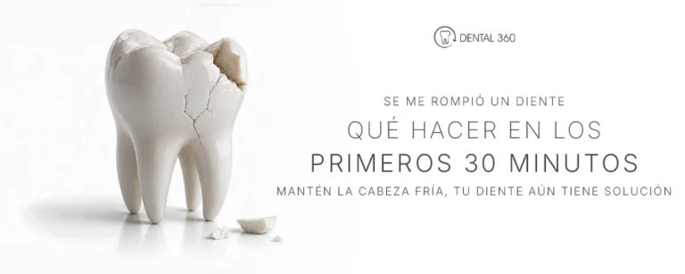Diente fracturado junto al texto se me rompió un diente y qué hacer en los primeros 30 minutos