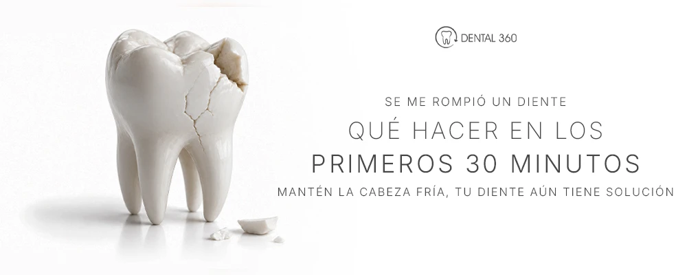 Diente fracturado junto al texto se me rompió un diente y qué hacer en los primeros 30 minutos