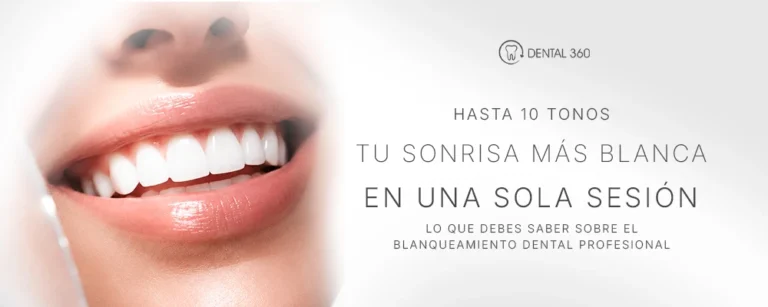 Paciente realizando blanqueamiento dental profesional con tecnología Beyond Polus Advanced Ultra