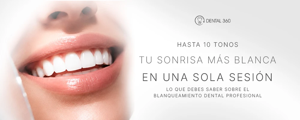 Paciente realizando blanqueamiento dental profesional con tecnología Beyond Polus Advanced Ultra