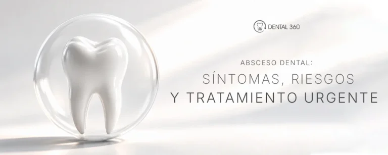 Paciente con absceso dental y dolor de muela. Conoce los síntomas, riesgos y tratamientos urgentes para una infección dental.